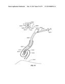 Minimally Invasive Lung Volume Reduction Devices, Methods, and Systems diagram and image