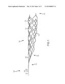 ENDOVASCULAR DEVICE ENGAGEMENT diagram and image