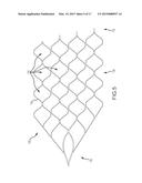 ENDOVASCULAR DEVICE ENGAGEMENT diagram and image