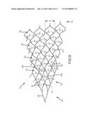 ENDOVASCULAR DEVICE ENGAGEMENT diagram and image