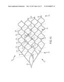 ENDOVASCULAR DEVICE ENGAGEMENT diagram and image