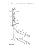 ENDOVASCULAR DEVICE ENGAGEMENT diagram and image