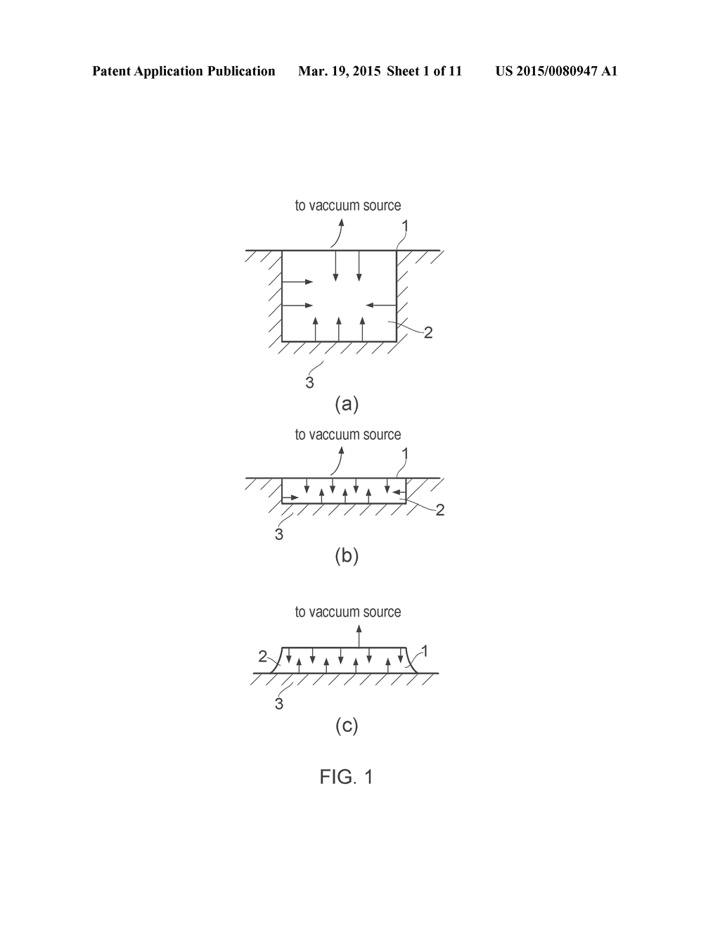 VACUUM CLOSURE DEVICE - diagram, schematic, and image 02