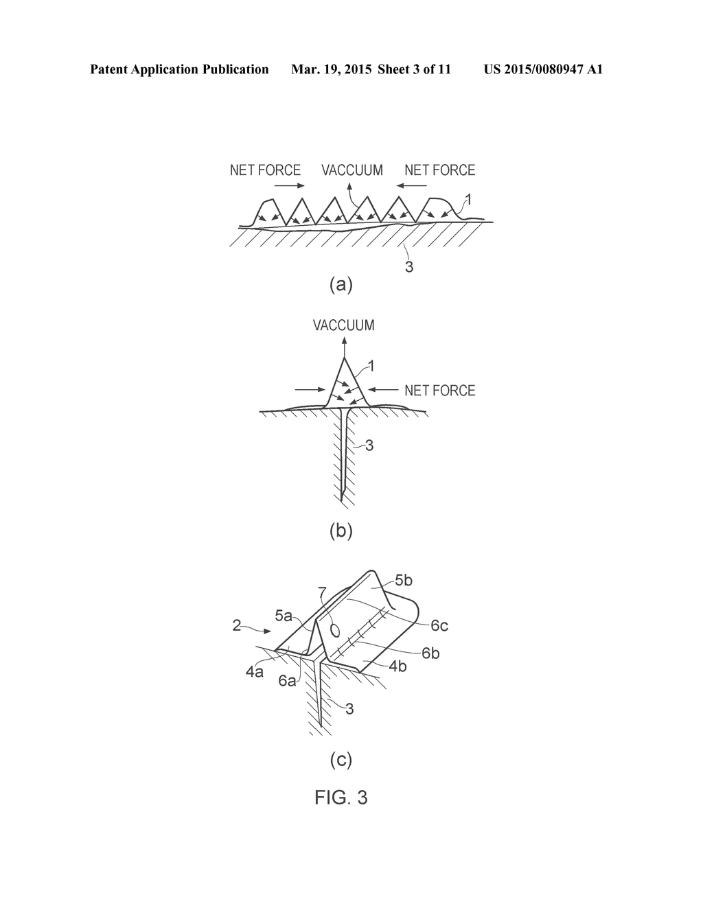 VACUUM CLOSURE DEVICE - diagram, schematic, and image 04