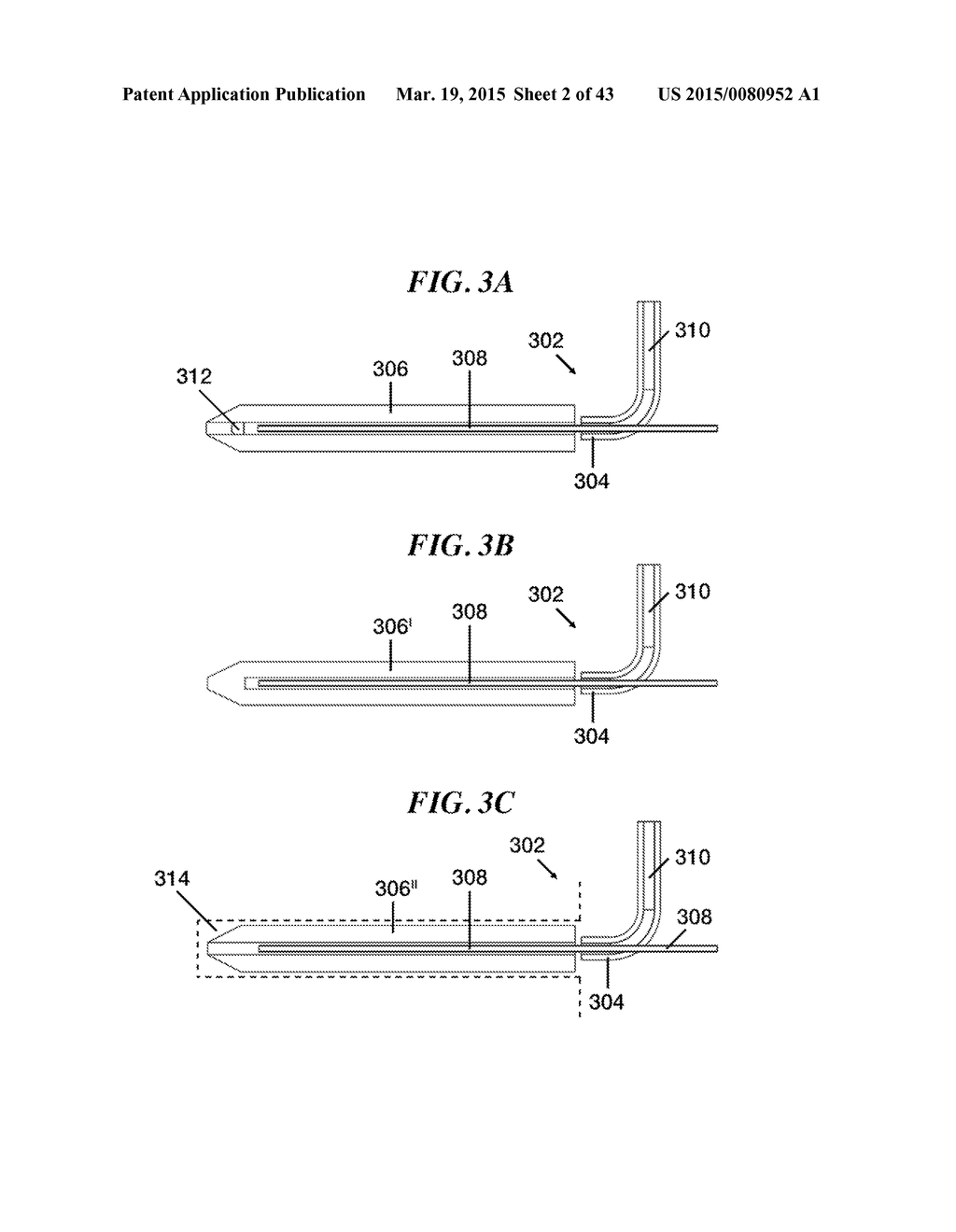 METHODS AND DEVICES FOR APPLYING LOCALIZED THERMAL THERAPY - diagram, schematic, and image 03