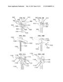 METHODS AND DEVICES FOR APPLYING LOCALIZED THERMAL THERAPY diagram and image