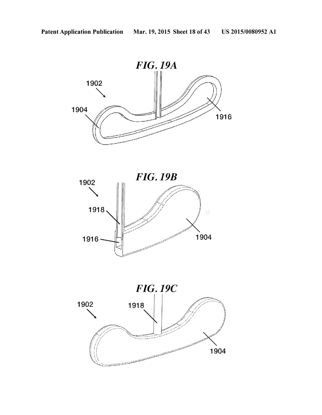 METHODS AND DEVICES FOR APPLYING LOCALIZED THERMAL THERAPY - diagram, schematic, and image 19