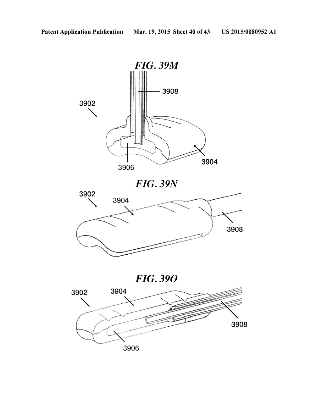 METHODS AND DEVICES FOR APPLYING LOCALIZED THERMAL THERAPY - diagram, schematic, and image 41