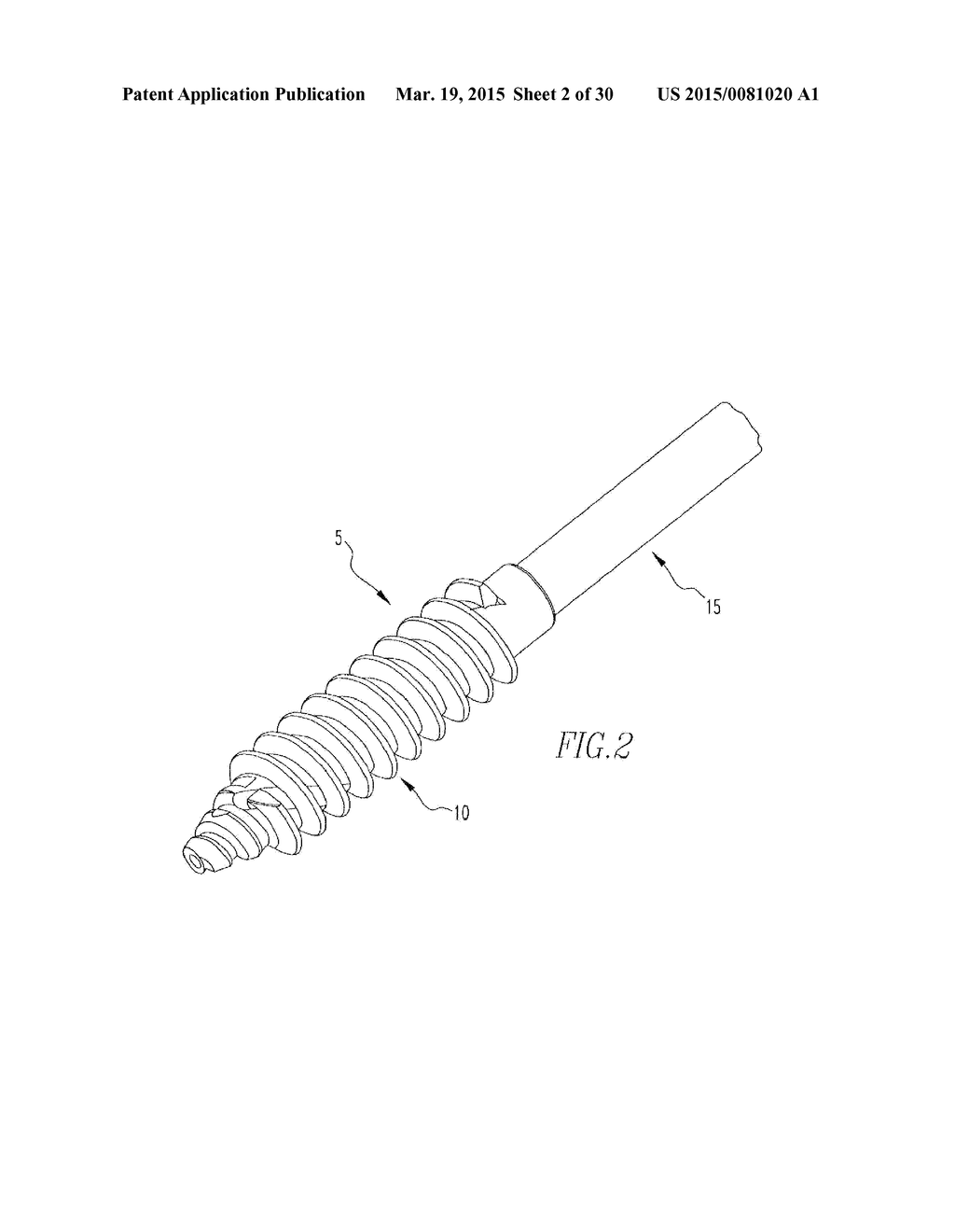 HELICOIL INTERFERENCE FIXATION SYSTEM FOR ATTACHING A GRAFT LIGAMENT TO A     BONE - diagram, schematic, and image 03