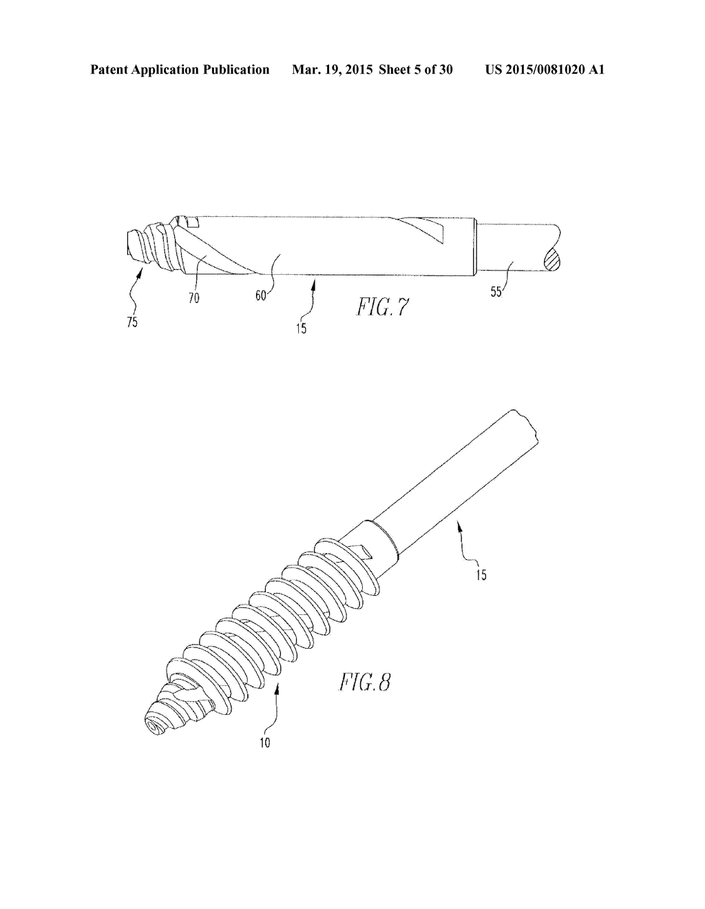 HELICOIL INTERFERENCE FIXATION SYSTEM FOR ATTACHING A GRAFT LIGAMENT TO A     BONE - diagram, schematic, and image 06