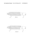 HELICOIL INTERFERENCE FIXATION SYSTEM FOR ATTACHING A GRAFT LIGAMENT TO A     BONE diagram and image