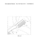 HELICOIL INTERFERENCE FIXATION SYSTEM FOR ATTACHING A GRAFT LIGAMENT TO A     BONE diagram and image