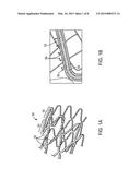 Methods Of Loading A Hollow Stent With A Drug Or Drug Formulation diagram and image