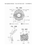 NONINVASIVE MEASUREMENT OF CHEMICAL SUBSTANCES diagram and image