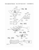 NONINVASIVE MEASUREMENT OF CHEMICAL SUBSTANCES diagram and image