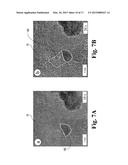 HIGH SURFACE AREA NANO-STRUCTURED GRAPHENE COMPOSITES AND CAPACITIVE     DEVICES INCORPORATING THE SAME diagram and image