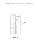 SYSTEMS AND METHODS FOR VISUALIZING ELONGATED STRUCTURES AND DETECTING     BRANCHES THEREIN diagram and image