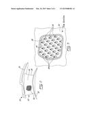 INTERNALLY COOLED AIRFOIL diagram and image