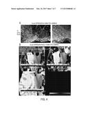 DIAGNOSIS AND TREATMENT OF PARKINSON S DISEASE diagram and image