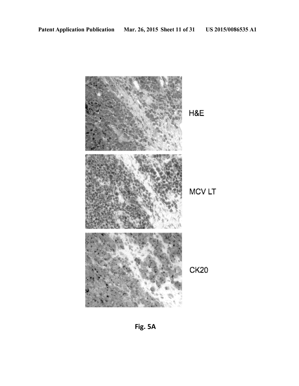 Use of Survivin Antagonists in Polyomavirus-Related Disease - diagram, schematic, and image 12