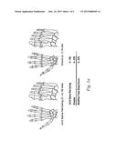 Use of TNFalpha Inhibitor for Treatment of Erosive Polyarthritis diagram and image