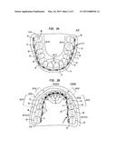 Bracket System diagram and image