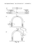 METHOD OF NUCLEIC ACID AMPLIFICATION diagram and image