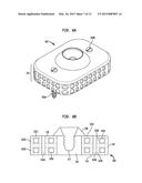 Osteoconductive Implantable Component for a Bone Conduction Device diagram and image