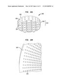 Osteoconductive Implantable Component for a Bone Conduction Device diagram and image