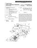 METHOD OF PLACING IMPLANT INDWELLING diagram and image