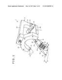 METHOD OF PLACING IMPLANT INDWELLING diagram and image