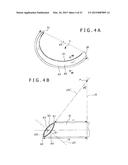 METHOD OF PLACING IMPLANT INDWELLING diagram and image