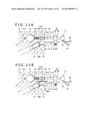 METHOD OF PLACING IMPLANT INDWELLING diagram and image