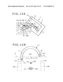 METHOD OF PLACING IMPLANT INDWELLING diagram and image