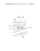 METHOD OF PLACING IMPLANT INDWELLING diagram and image