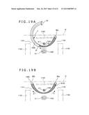 METHOD OF PLACING IMPLANT INDWELLING diagram and image