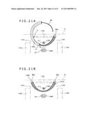 METHOD OF PLACING IMPLANT INDWELLING diagram and image