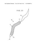 METHOD OF PLACING IMPLANT INDWELLING diagram and image