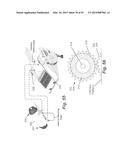 IMAGE-GUIDED THERAPY OF A TISSUE diagram and image