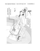 IMAGE-GUIDED THERAPY OF A TISSUE diagram and image