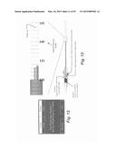 IMAGE-GUIDED THERAPY OF A TISSUE diagram and image