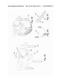 IMAGE-GUIDED THERAPY OF A TISSUE diagram and image