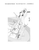 IMAGE-GUIDED THERAPY OF A TISSUE diagram and image