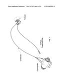 MONITORING AND NOISE MASKING OF THERMAL THERAPY diagram and image