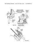 MONITORING AND NOISE MASKING OF THERMAL THERAPY diagram and image