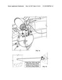 MONITORING AND NOISE MASKING OF THERMAL THERAPY diagram and image