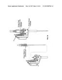 MONITORING AND NOISE MASKING OF THERMAL THERAPY diagram and image