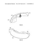 MONITORING AND NOISE MASKING OF THERMAL THERAPY diagram and image