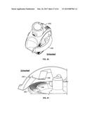 MONITORING AND NOISE MASKING OF THERMAL THERAPY diagram and image