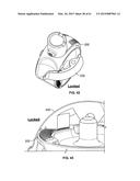 MONITORING AND NOISE MASKING OF THERMAL THERAPY diagram and image